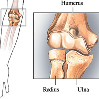 Elbow diagram