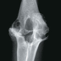 Elbow X-ray