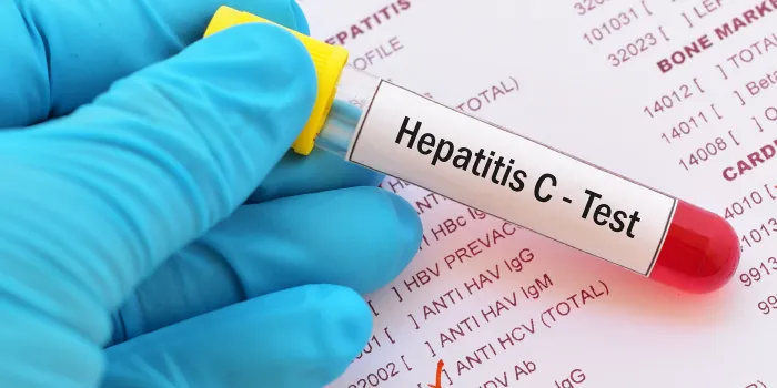 Hepatitis C, Medical Test, Medical Exam, Hepatitis, Scientific Experiment