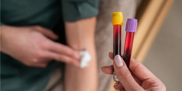 What Is Therapeutic Phlebotomy?