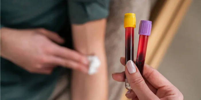  What Is Therapeutic Phlebotomy Treatment And Conditions HemAware