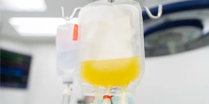 What’s the Difference Between Plasmapheresis and Therapeutic Plasma Exchange?