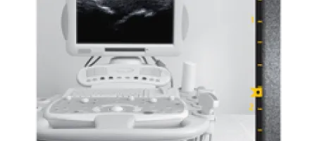 Medical ultrasound scan