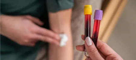 What Is Therapeutic Phlebotomy?