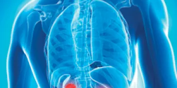 Blue X-ray highlighting kidneys in red